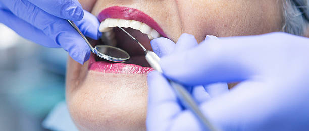 Best Pediatric Emergency Dentist in Aspen Hill, MD
